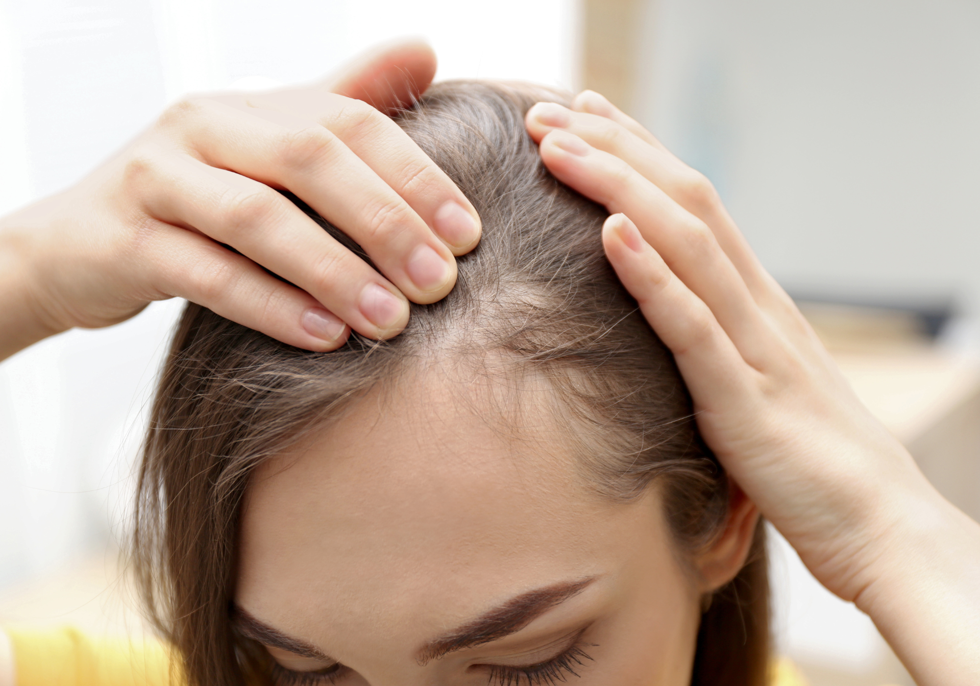 So wählst Du die richtigen Nahrungsergänzungsmittel gegen Haarausfall aus