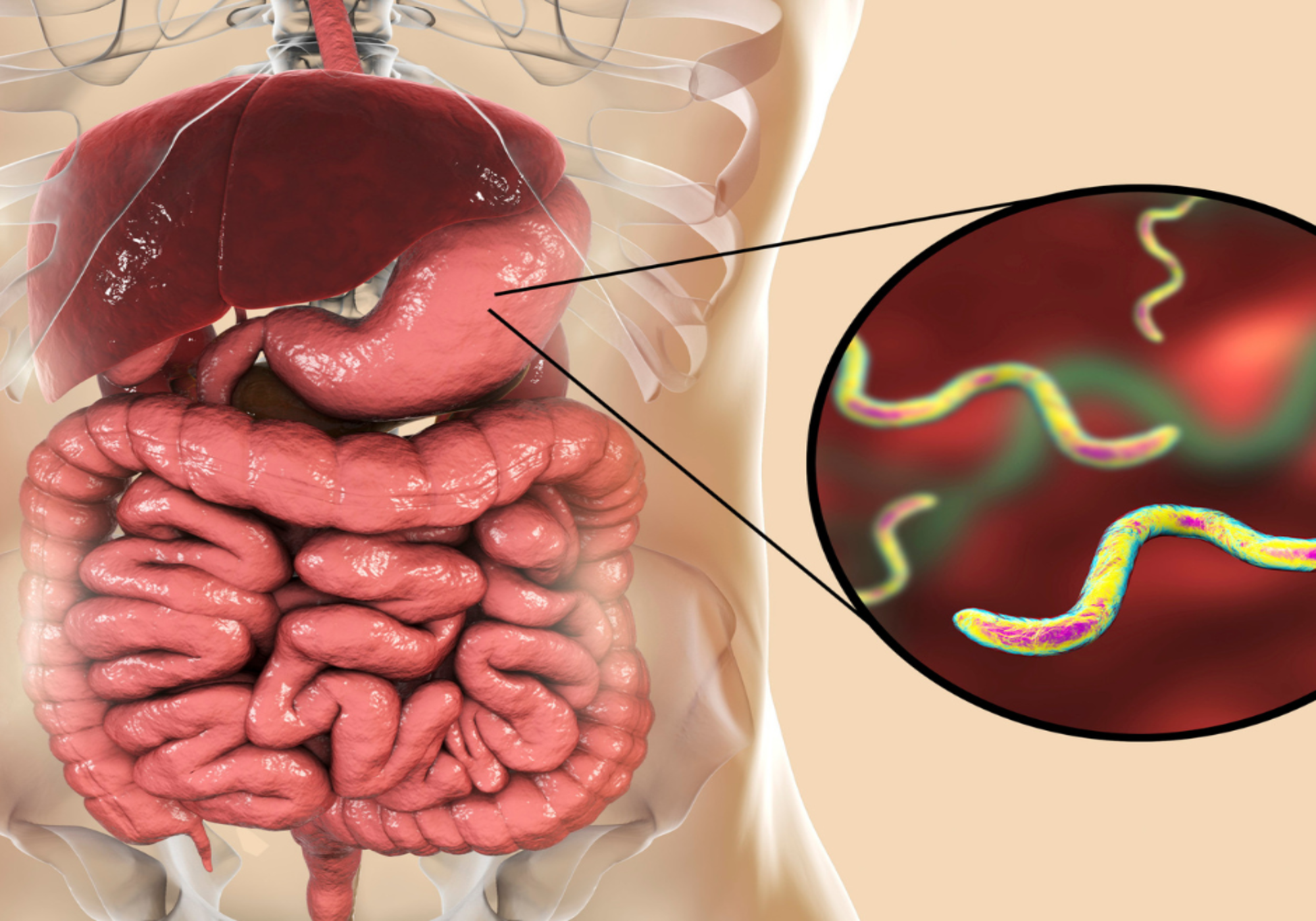 Helicobacter pylori. Ursachen, Symptome und ...