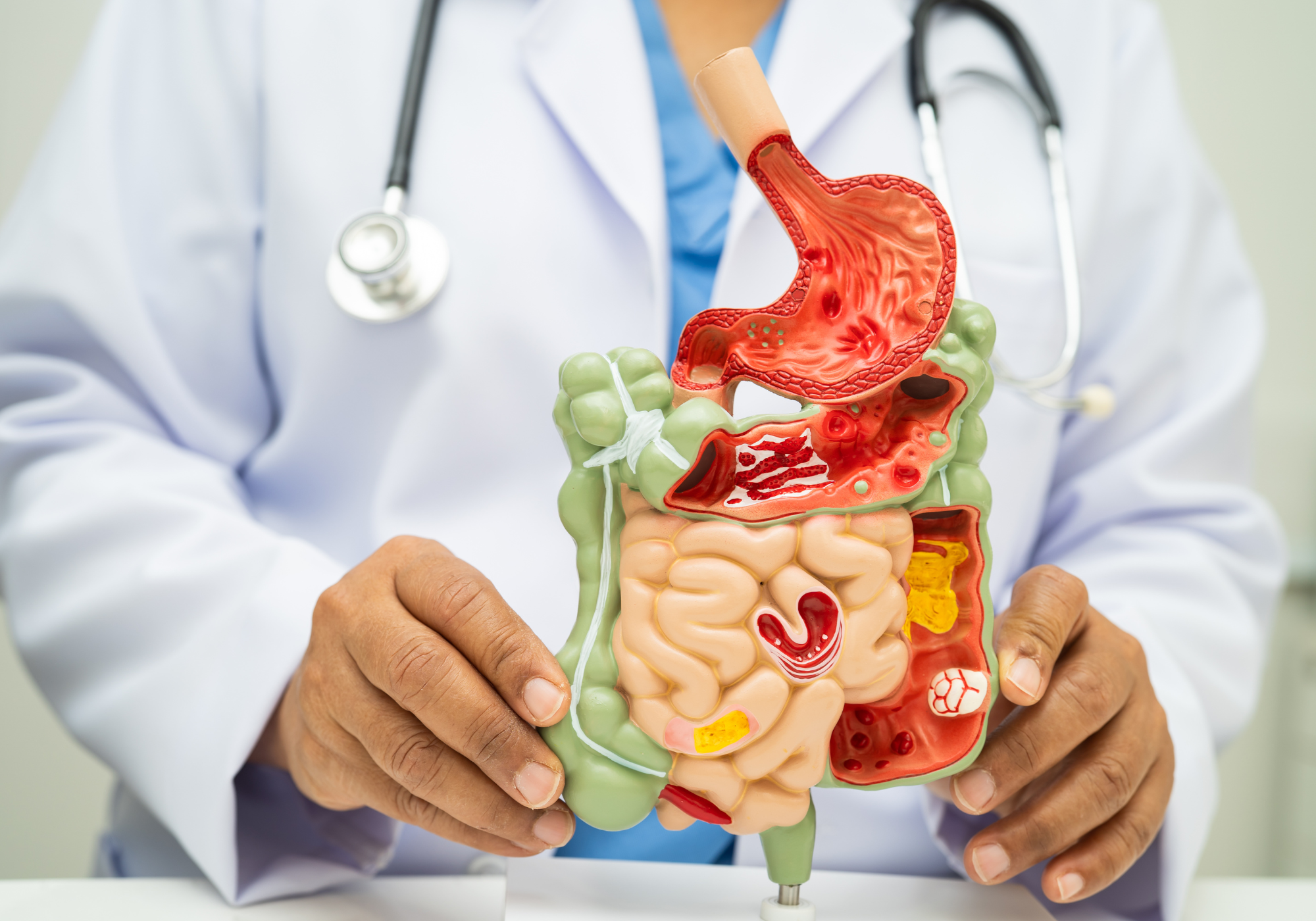 Darmgesundheit verbessern: Ursachen verstehen und die Magen-Darm-Balance stärken