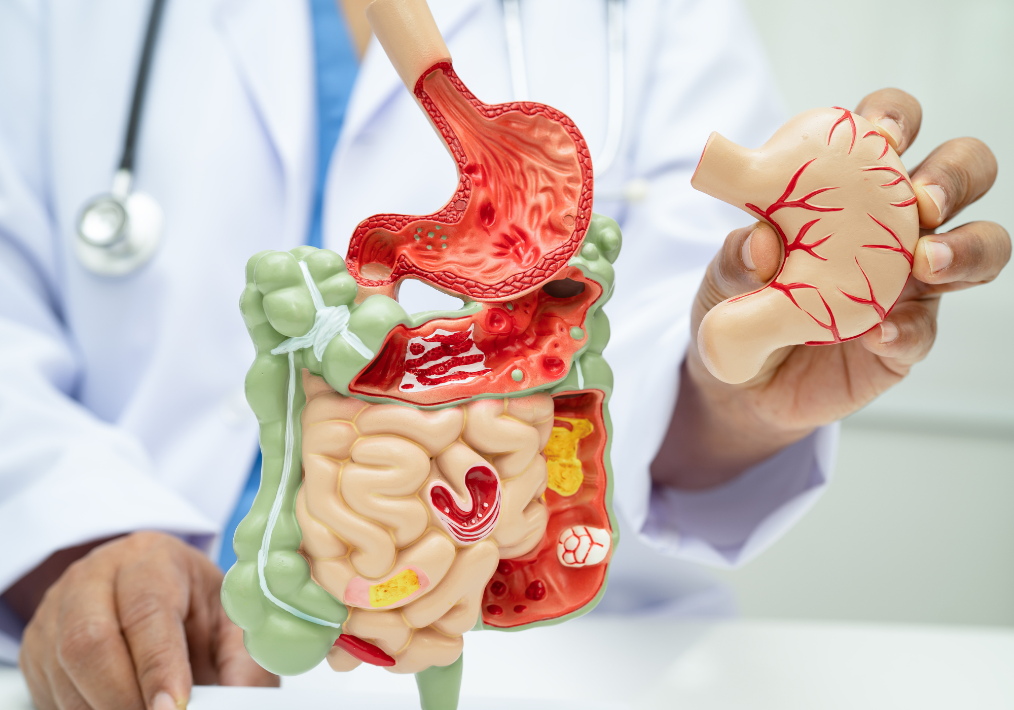 Darmflora verbessern bei Stress: Neurobiologische Zusammenhänge und Hilfe für den empfindlichen Bauch